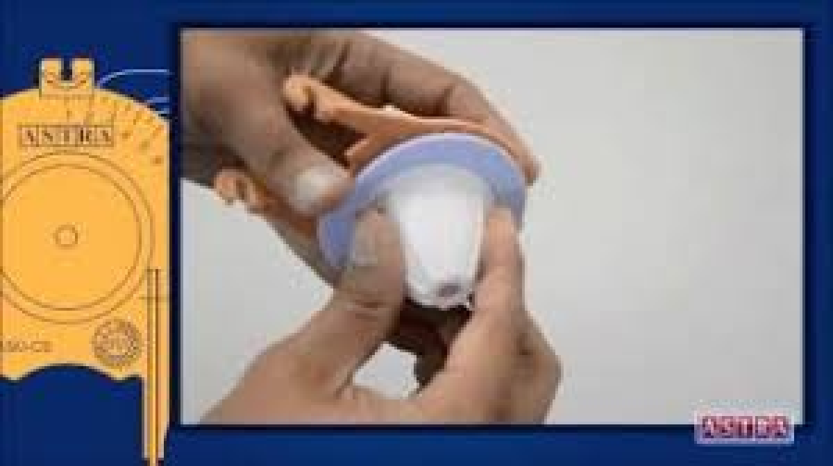 Vedante Silicone para Sapinho Astra Rígido
