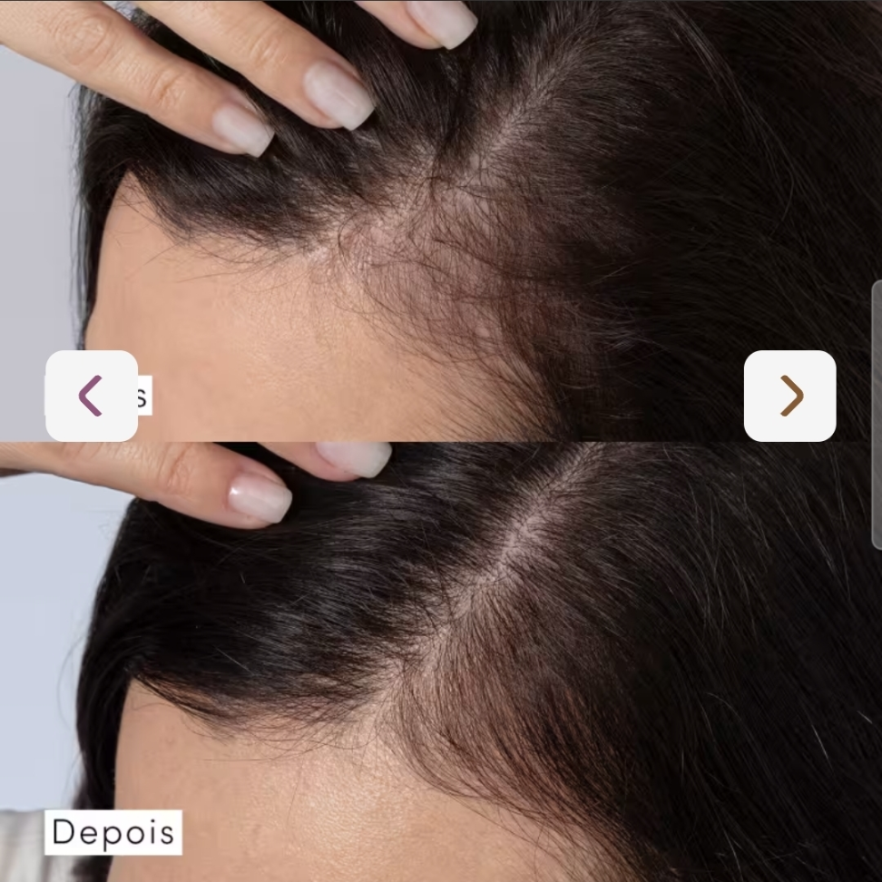 Condicionador Dermo Hair Anti Queda Siage 280ml - #3